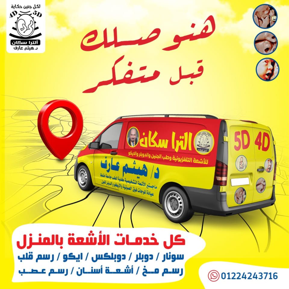 سيارة السونار المنزلي - الترا سكان